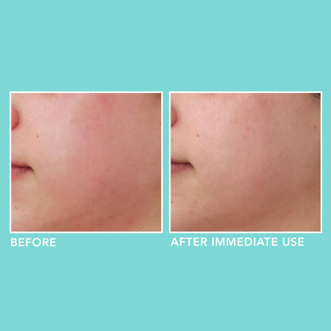 Soothe and Hyaluronic Acid Hydrate Serum, 0.5 Fl Oz