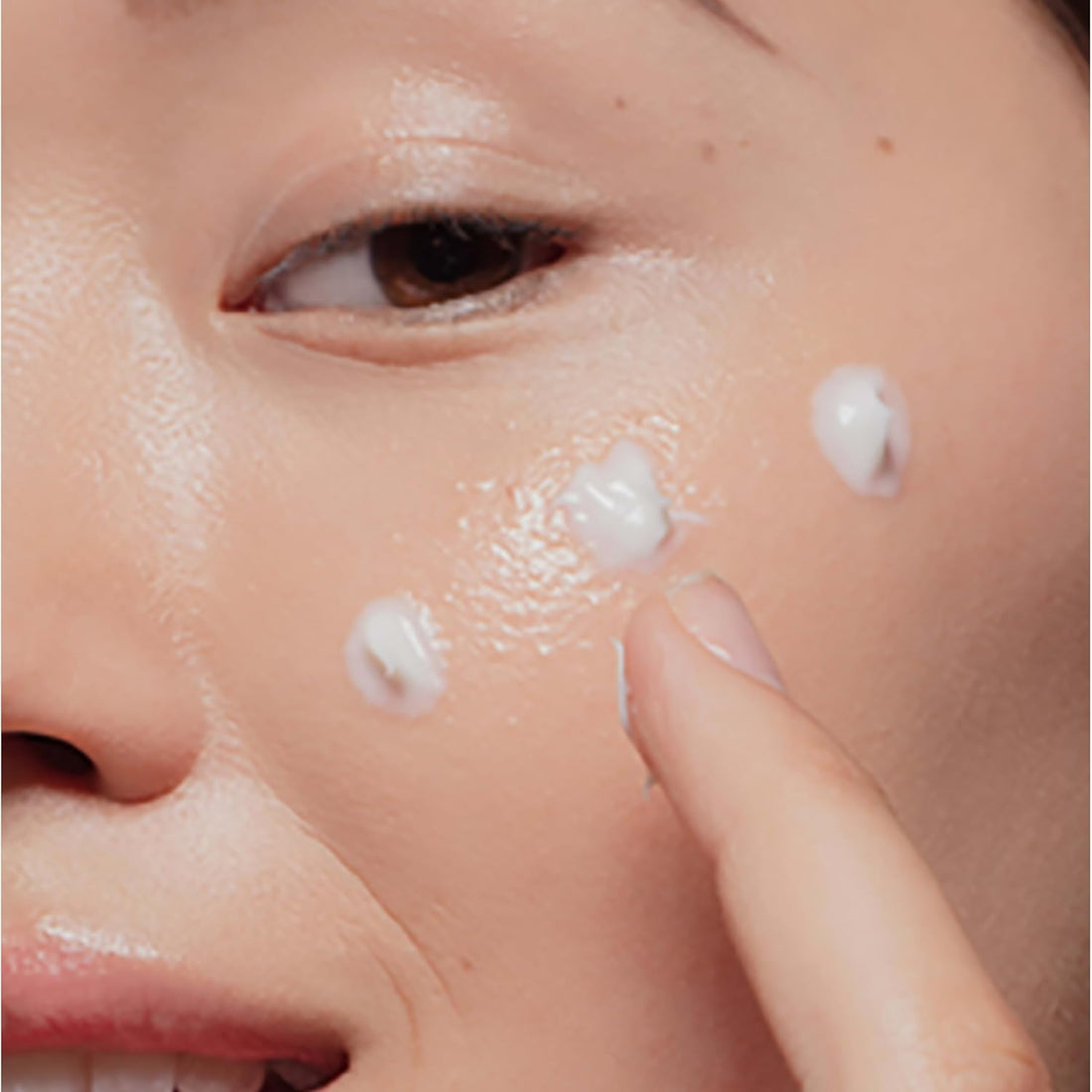 On-The-Spot Acne Spot Treatment Cream with 2.5% Benzoyl Peroxide