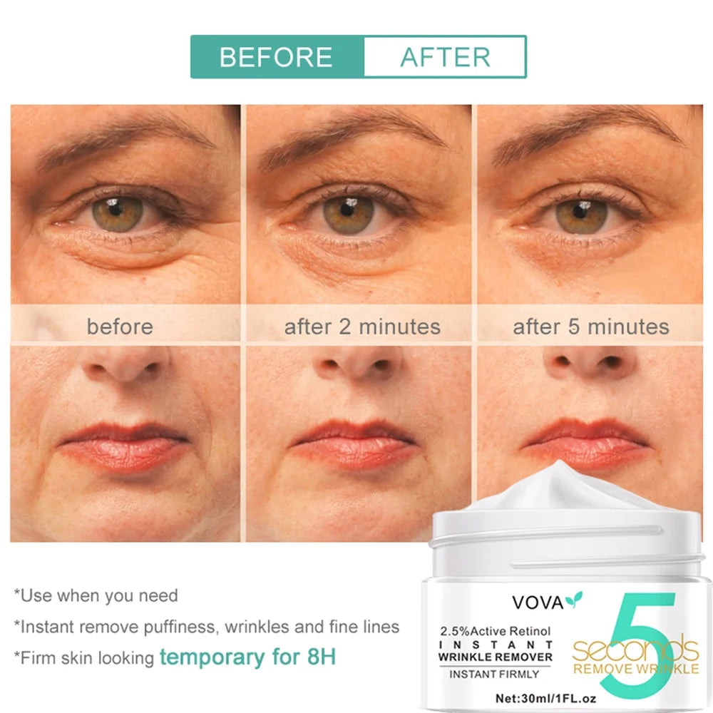 Eye Creams for Anti-Aging and Wrinkle