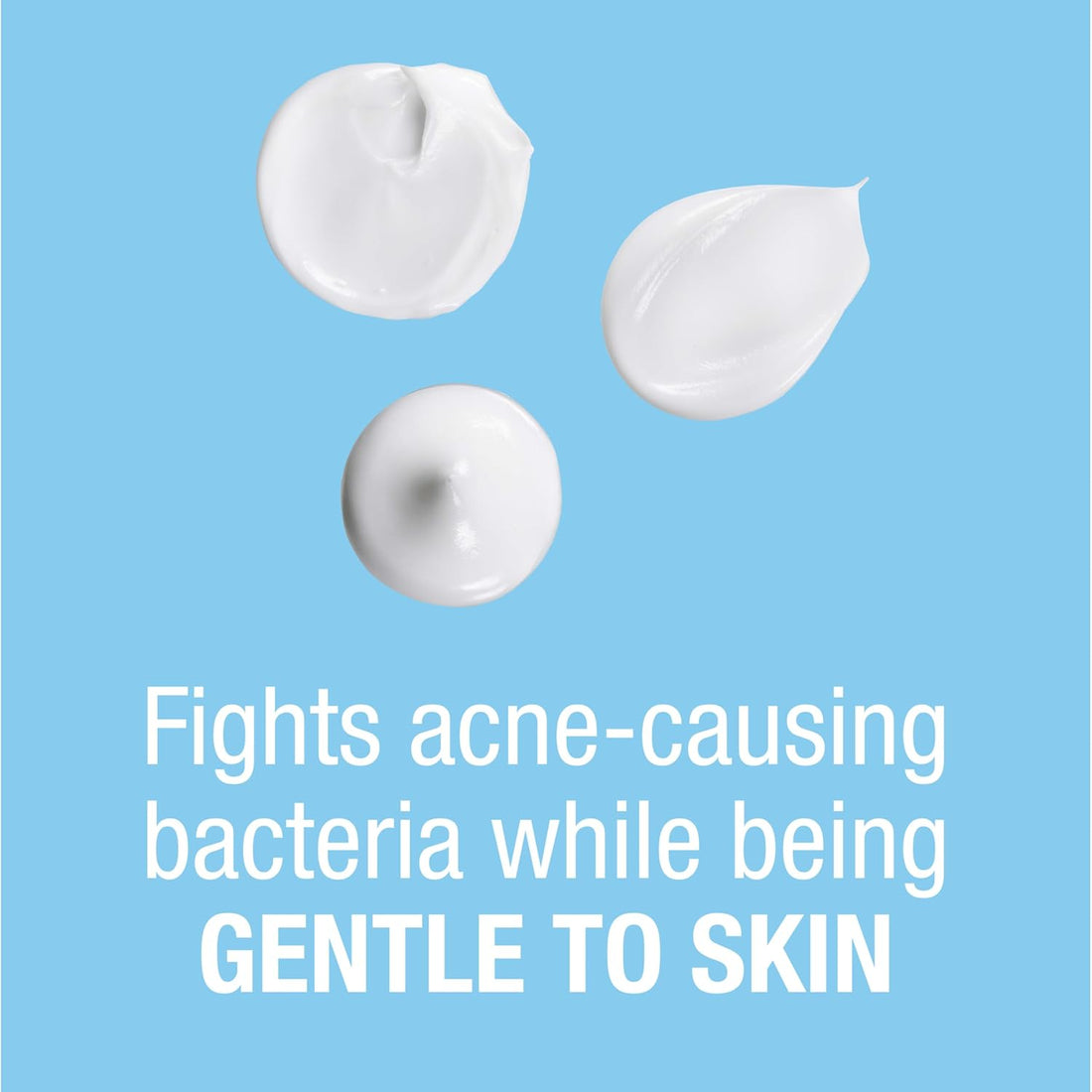 On-The-Spot Acne Spot Treatment Cream with 2.5% Benzoyl Peroxide
