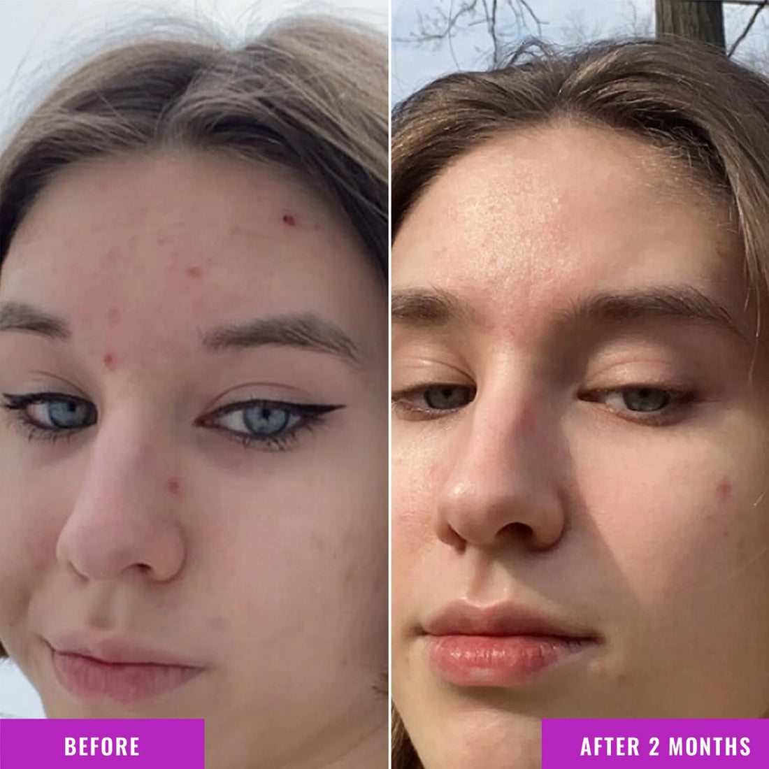 Good Molecules Niacinamide Serum - 10% Niacinamide B3 Facial Serum