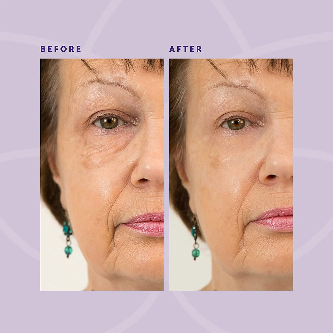 Eye Creams for Anti-Aging and Wrinkle