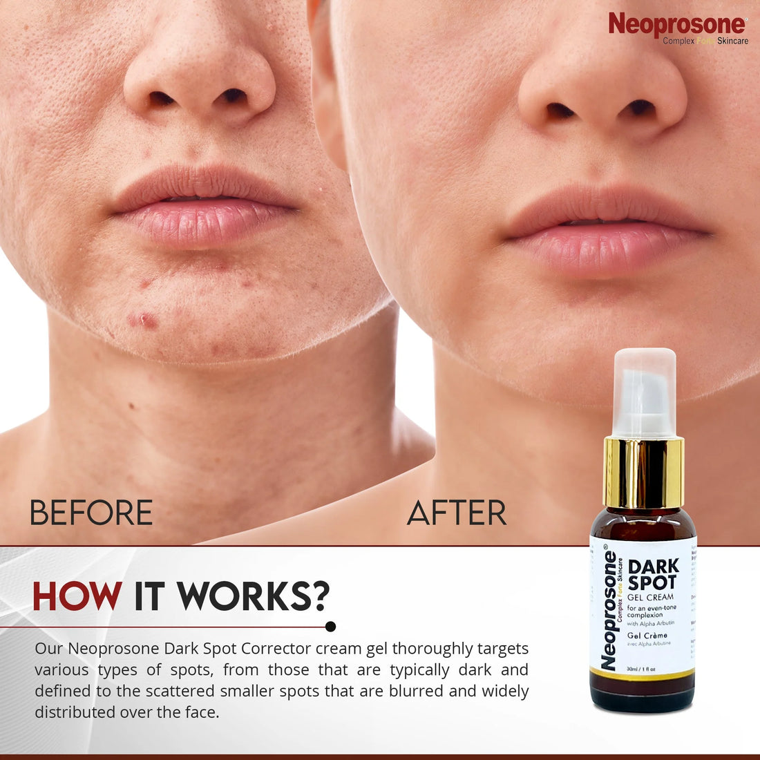 Dark Spot Remover for Face - 1 Fl Oz / 30 Ml 
